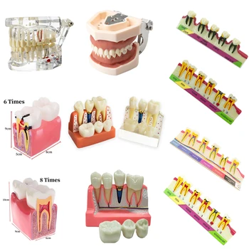 1шт Стоматологическая модель Реставрация имплантатов Патологическая модель зуба Обучение стоматологии Демонстрационное Обучение стоматолога Съемная модель зубов